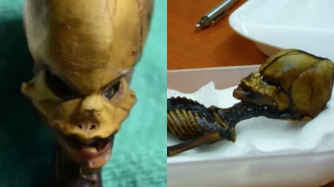 Experts solved mystery behind Ata 'alien’ skeleton after more than 20 years