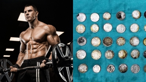 Weightlifter almost lost his life after eating 39 coins and 37 magnets to support bodybuilding progress