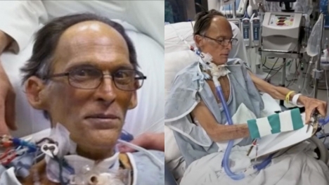 World's first man lives for a month without a heart or a pulse 