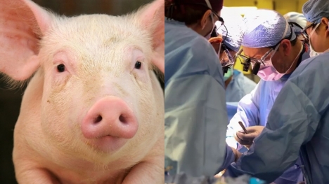 Doctors make breakthrough in medicine after successfully transplanting pig kidney into human