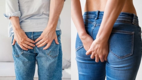People are just realizing why they get 'shooting pain' in their bum