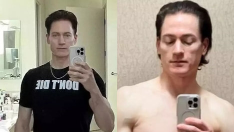 Biohacker who spends $2M annually to reverse age claims victory over balding and graying hair