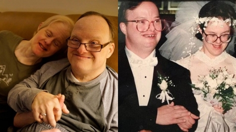 The couple with Down syndrome had been together for 25 years, only separating when their husband died