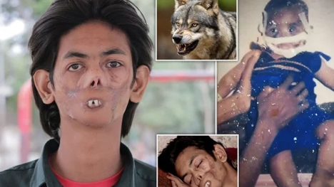 The 18-year-old boy is shunned by the villagers and called 'the ghost boy' because of his disfigured appearance