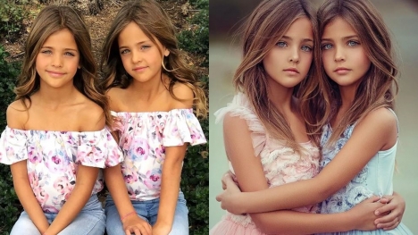 The most beautiful twin sisters in the world, possessing extraordinary looks after 13 years