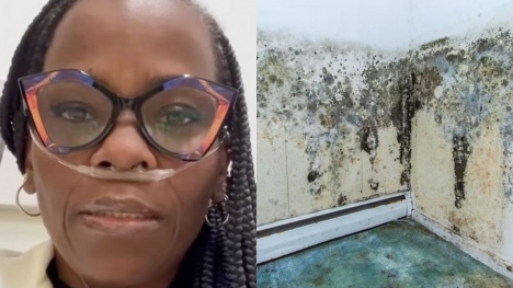 Woman needs new lungs after contracting life-threatening disease from mould exposure in apartment