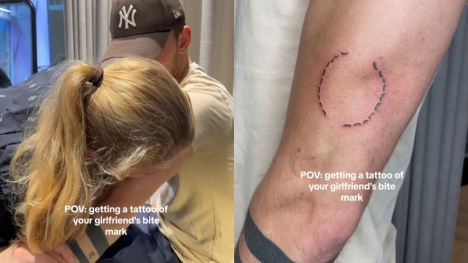Man roasted for 'dumbest tattoo ever' after showing off bite mark tattoo