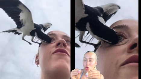 Woman almost loses an eye to swooping magpie