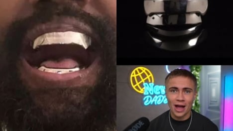 Tiktoker left stunned after explaining how Kanye West cleans his $850,000 titanium teeth