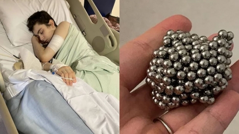 Boy, 12, undergoes six-hour surgery after swallowing 54 magnets to see if he'd become magnetic 