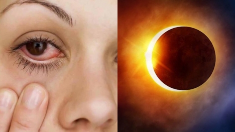 Google search data for 'Why do my eyes hurt' increase in dizzy spells after solar eclipse phenomenon