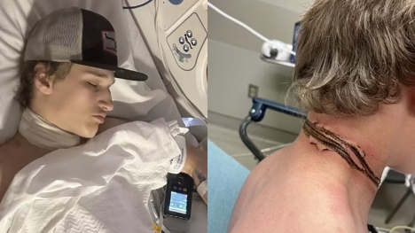 Teen nearly loses life after necklace is electrocuted by phone charger