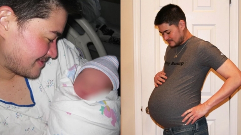 World's first pregnant man gave birth to his three children