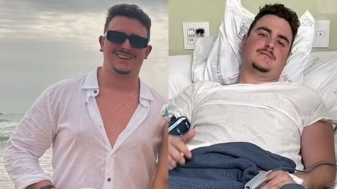 Man who partied for 4 days had no idea he had been shot in the head