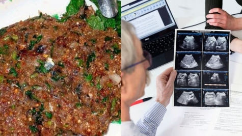 Just one bite of this meal can give you liver tumor