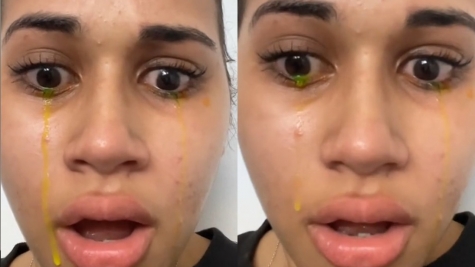 Woman left people stunned after crying with bizarre yellow 