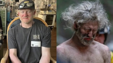 Missing hiker in Santa Cruz mountains survives by drinking water from boot for 10 days