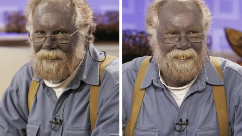 A man turned blue after long-term use of dietary supplements