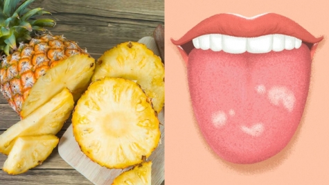 Here's the reason why eating far too much pineapple can make your tongue bleed