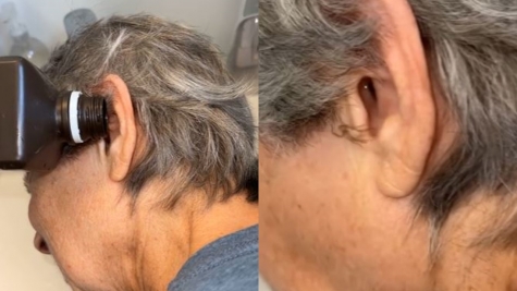 Moment insects removed from mum's blocked ear leave people unable to sleep 