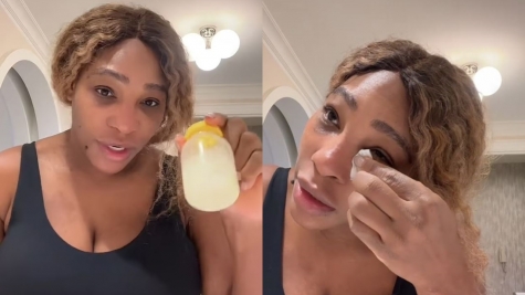 Serena Williams left fans BAFFLED after revealing she uses breast milk to help heal sunburn