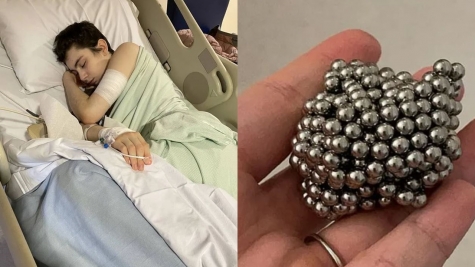 Boy, 12, undergoes six-hour surgery after swallowing 54 magnets to see if he'd become magnetic 