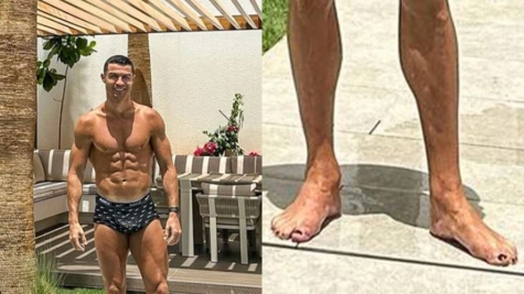 Unraveling the reason why Cristiano Ronaldo is wearing black nail polish on his toes