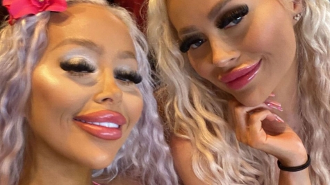 How twins spent £160,000 on surgery to resemble Barbie dolls