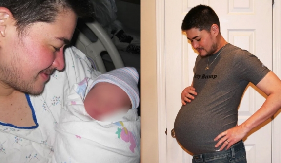 World's first pregnant man gave birth to his three children