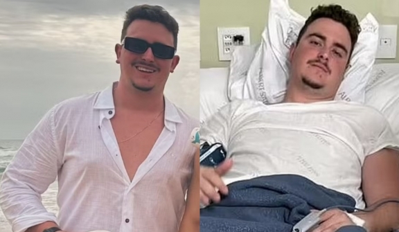 Man who partied for 4 days had no idea he had been shot in the head