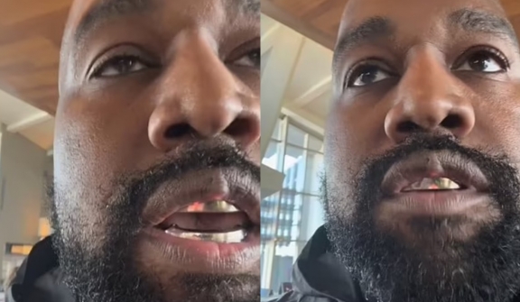 Mysterious lump on Kanye West's upper lip makes fans curious about its origin