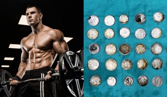 Weightlifter almost lost his life after eating 39 coins and 37 magnets to support bodybuilding progress