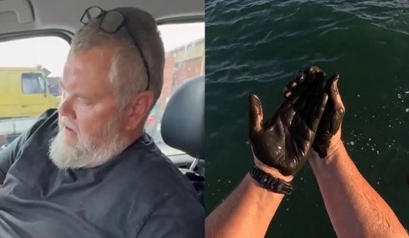 Man suffered awful outcome after five days as he rubbed squid ink on himself