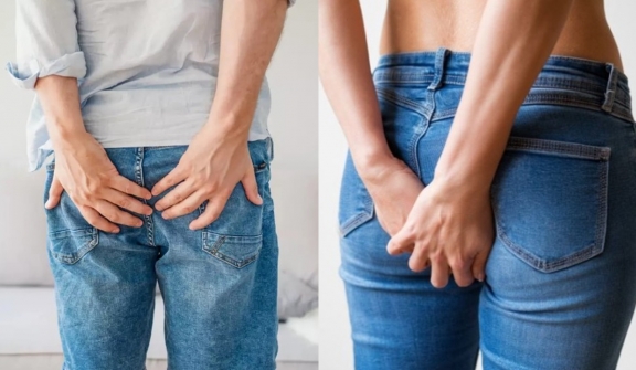 People are just realizing why they get 'shooting pain' in their bum