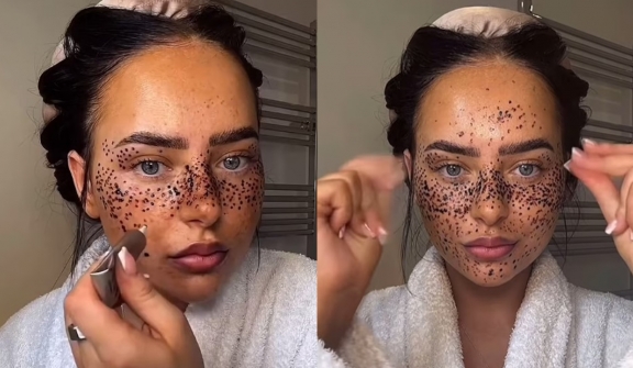 Influencer criticized for painting henna 'freckles' on face to mock people with skin pigment issues