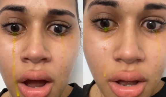 Woman left people stunned after crying with bizarre yellow 