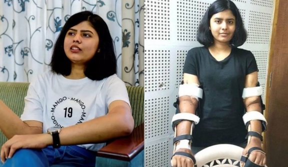 Woman's transplanted 'man hands' became lighter, hairless and more feminine to match her body