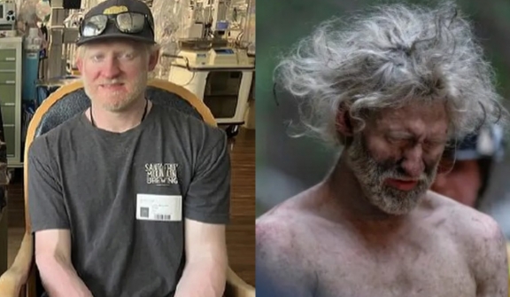 Missing hiker in Santa Cruz mountains survives by drinking water from boot for 10 days