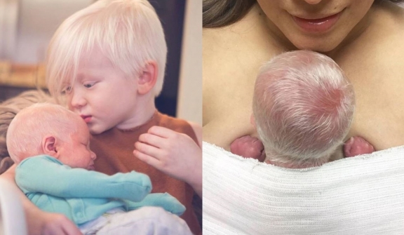 Giving birth to a child with white snow hair, the mother is unaware of the child's dangerous illness