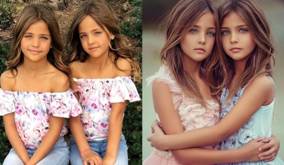 The most beautiful twin sisters in the world, possessing extraordinary looks after 13 years