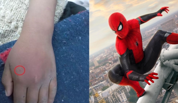 Boys let black widow spider bite them in hopes of gaining 'superpowers' and turning into Spider-Man