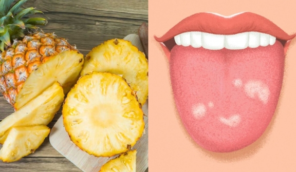 Here's the reason why eating far too much pineapple can make your tongue bleed