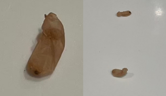 Baffled mum begs for help after discovering 'beans' in her bathroom