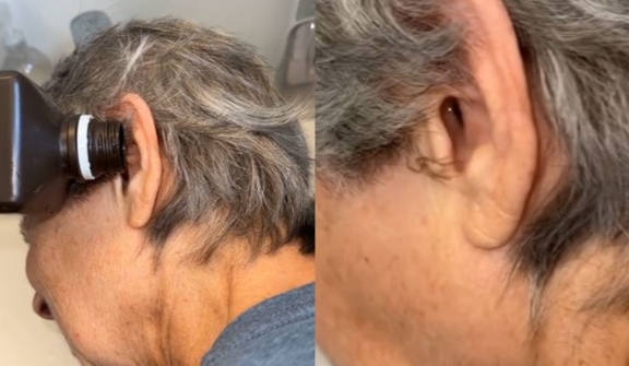 Moment insects removed from mum's blocked ear leave people unable to sleep 