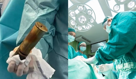 Hospital evacuated after an 88-year-old man arrives with a World War I artillery stuck in rectum