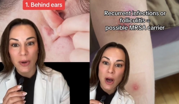 Dermatologist warns you've been showering WRONG: what happens if you skip washing these body parts? 