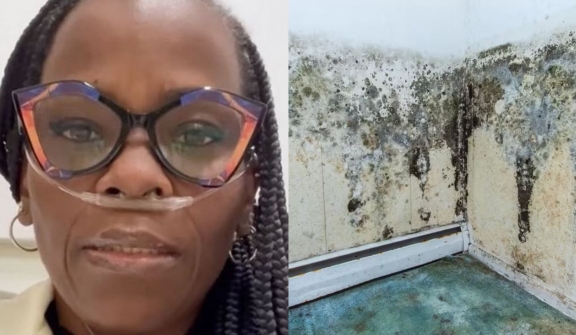 Woman needs new lungs after contracting life-threatening disease from mould exposure in apartment