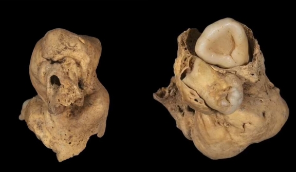 Tumor with TEETH is unearthed in the remains of ancient Egyptian woman 