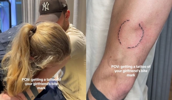 Man roasted for 'dumbest tattoo ever' after showing off bite mark tattoo
