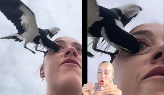 Woman almost loses an eye to swooping magpie